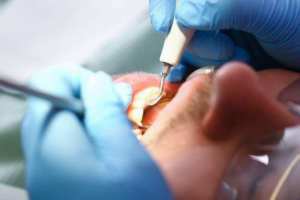 Best Emergency Dentist for Knocked-Out Tooth in Baldwin, GA