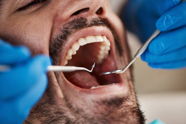 Best Mobile Emergency Dentist in Baldwin, GA